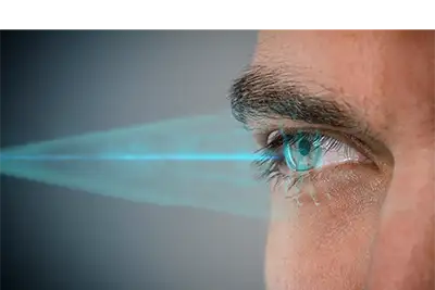 Augenlasern Brillenversicherung ohne Wartezeit